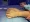Melanie Klein's hand after the shark attack